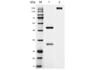 Recombinant Human Anti-TSHR Antibody (M22)