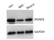 Ideal Antibody From Cell Signaling Technology For Western Blot With a Clear Signal