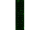 The Human MMP Array From RayBiotech is Worth the Purchase