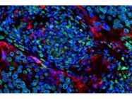 PathPlex® Multiplex IHC Panels