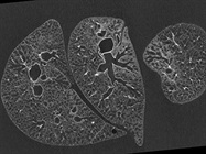 X-Ray Microscopy: Versatile Tool for Life Sciences Imaging