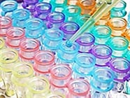 Choosing the Right ELISA Kit