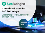 Claudin 18 Antibody, Rabbit MAb
