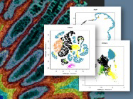 A Glimpse into StrataQuest 8 Features: Neighborhood Analysis in Colorectal Cancer