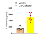 Highly Sensitive and Easy-To-Use Human IL-8 ELISA Kit