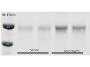 Fibrin Detected by Western Blot in Mouse Lungs