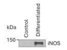 Optimal Kit From R&D Systems for Differentiating CD14+ Cells into the M1 Phenotype