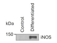 Optimal Kit From R&D Systems for Differentiating CD14+ Cells into the M1 Phenotype