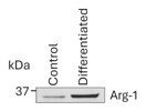 Excellent Kit for Differentiating CD14+ THP-1 Cells into an M2 Phenotype.