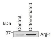 Excellent Kit for Differentiating CD14+ THP-1 Cells into an M2 Phenotype.