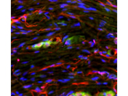 Decent Anti-Glial Fibrillary Acidic Protein Antibody for DRG Staining