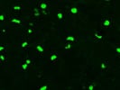Highly Recommended Sox10 Antibody From Bethyl Laboratories for Studying Mouse Oligodendrocytes