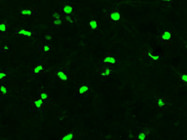 Highly Recommended Sox10 Antibody From Bethyl Laboratories for Studying Mouse Oligodendrocytes