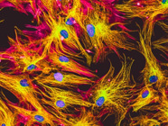 A Guide to Fibroblast Markers