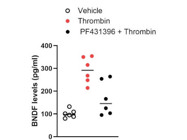 R&D Systems Offers a High-Quality BNDF Assay Kit