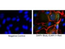 Discover the Perfect ICAM-1 Antibody, for Achieving Remarkable Immunofluorescence Staining