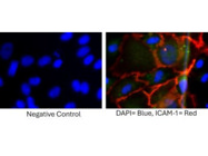 Discover the Perfect ICAM-1 Antibody, for Achieving Remarkable Immunofluorescence Staining