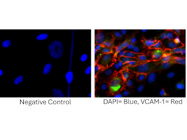 Highly Specific VCAM-1 Antibody From Thermo Fisher Scientific