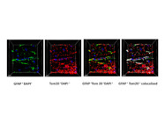 Tom20 Antibody From Proteintech Has Great Immunofluorescent Staining