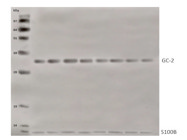 A Sensitive SLC25A18 Antibody to Measure GC2 Expression