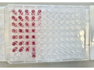 User Friendly Kit With Simple Protocol and Consistent Results