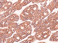 Introduction to Digital Immunohistochemistry