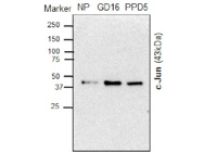 This Antibody From Cell Signaling is Ideal for the Detection of c-Jun in Mouse Pancreatic Tissue