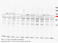 Tryptophan Hydroxylase 2 Antibody: Detection of Unwanted Multiple Additional Bands