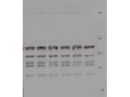 Highly Reliable Antibody for Accurate Detection of 5HT1A Receptor