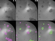 Organoids and AI: Unlocking the Mysteries of Cancer Immune Evasion and Immunotherapy