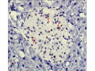 This EGR1 Antibody is an Excellent Choice for Accurately Detecting EGR1 in Pancreatic Islets Through IHC