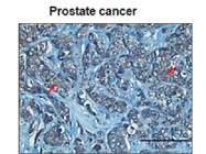 ACSL1 Antibody as a Marker in Mouse Prostate Cancer Tissues