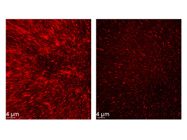 A Sensitive PSD-95 Antibody for Synaptic Analysis