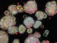 3D Organoids vs 2D Cell Lines in Drug Discovery and Disease Modeling