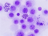 A Guide to Cell Cycle Markers