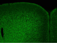 Clear Signal, Zero Hassle: The Go-To Anti-Myelin Basic Protein Antibody