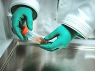 The Need for Better Control of Cell Handling Conditions