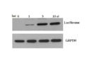 Western Blot Winner: This Antibody Delivers Strong, Clear Signals