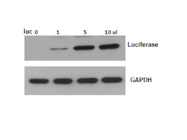 Western Blot Winner: This Antibody Delivers Strong, Clear Signals