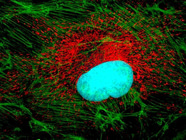 Ferroptosis Markers and Detection