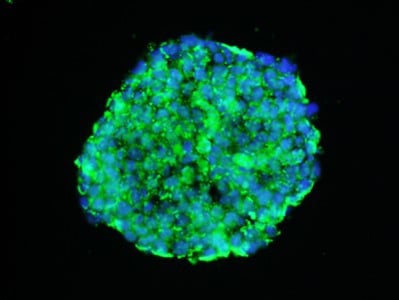 Imaging Systems for 3D Cell Cultures