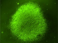 Organoids Promise to Accelerate Parkinson's and Alzheimer’s Research and Drug Discovery
