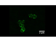An Optimized Dye for STED Imaging of Halo Tagged Proteins