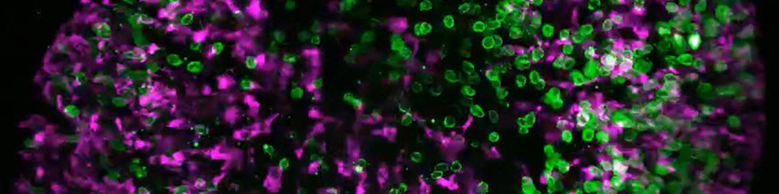 Overcoming Challenges in Live-Cell Imaging of 3D Cell Cultures ...