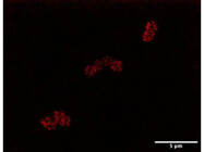 Brilliance Beyond Limits: A Clear, Bright Dye for Super-Resolution Imaging