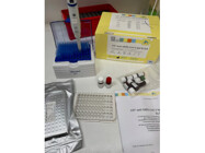 QuickQuant IgG™: Effortless, Accurate IgG Detection by Immundiagnostik