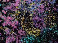 Next-Generation Spatial Transcriptomic Tools Transform RNA Detection in Degraded Samples