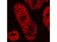High-Performance BRD4 Antibody for Immunofluorescence