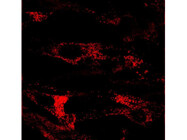 Highly Effective Lysosomal Marker for Immunofluorescence Applications
