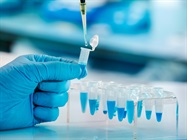 Advanced Technologies Streamlining PCR Workflows